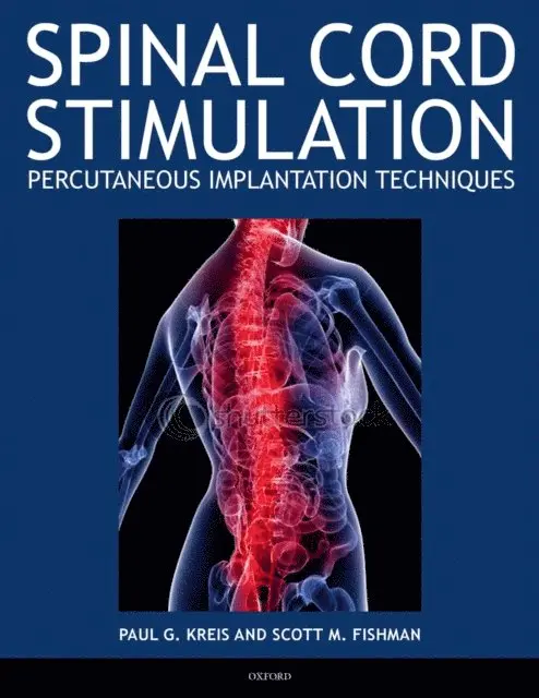 Scott Fishman, Paul Kreis - Spinal Cord Stimulation, E-bok. Tillgänglighet: Lägg i varukorg