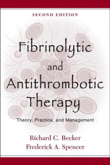Fibrinolytic and Antithrombotic Therapy