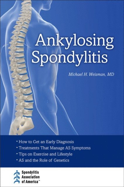 Michael H. Weisman - Ankylosing Spondylitis, E-bok