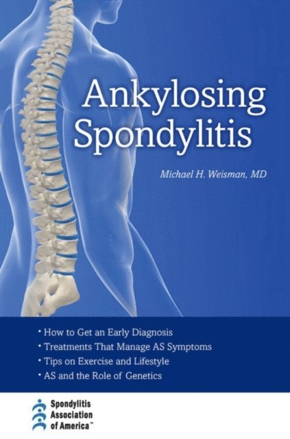 Michael H. Weisman - Ankylosing Spondylitis, E-bok