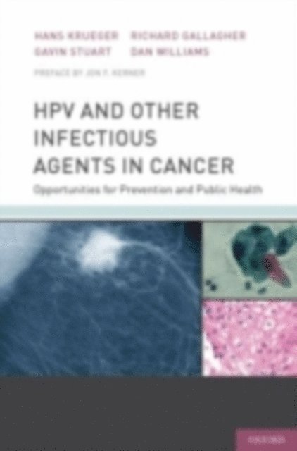 Dan Williams, Richard Gallagher, Gavin Stuart, Hans Krueger - HPV and Other Infectious Agents in Cancer, E-bok