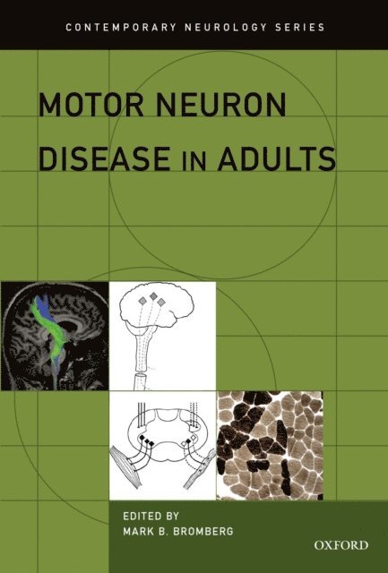 Mark Bromberg - Motor Neuron Disease in Adults, E-bok