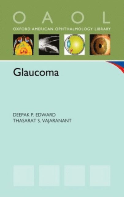 Thasarat S. Vajaranant, Deepak P. Edward - Glaucoma, E-bok. Tillgänglighet: Lägg i varukorg