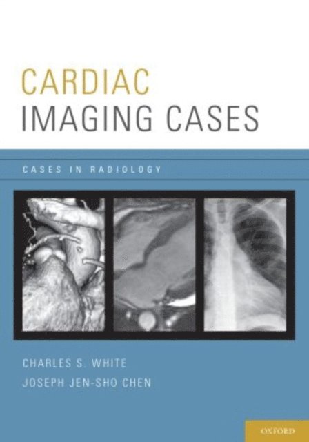 Joseph Chen, Charles White - Cardiac Imaging Cases, E-bok