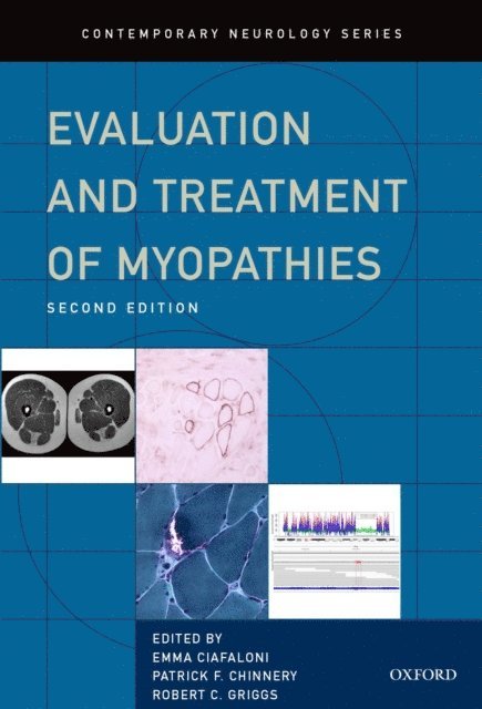 Robert Griggs, Patrick Chinnery, Emma Ciafaloni - Evaluation and Treatment of Myopathies, E-bok
