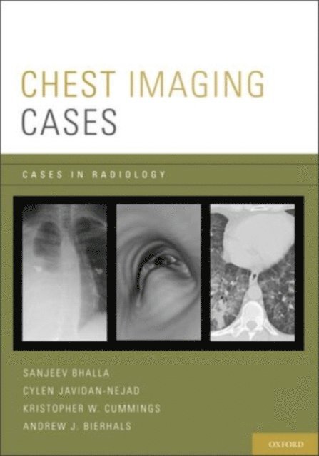 Andrew J. Bierhals, Kristopher W. Cummings, Cylen Javidan-Nejad, Sanjeev Bhalla - Chest Imaging Cases, E-bok