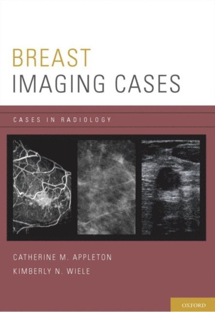 Kimberly N. Wiele, Catherine M. Appleton - Breast Imaging Cases, E-bok
