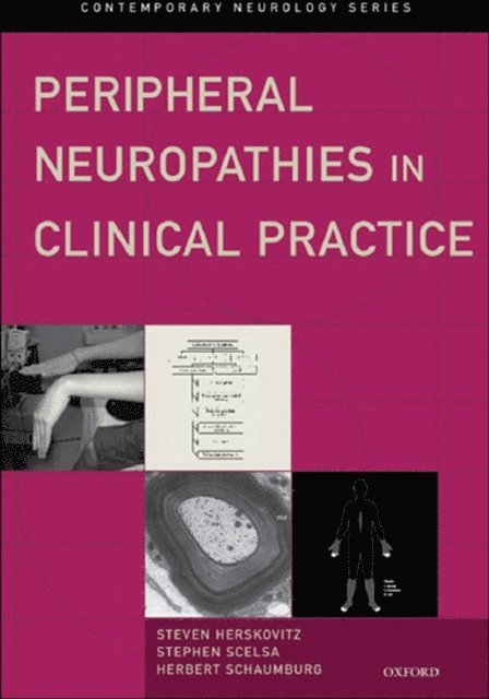 Herbert Schaumburg, Stephen Scelsa, Steven Herskovitz - Peripheral Neuropathies in Clinical Practice, E-bok