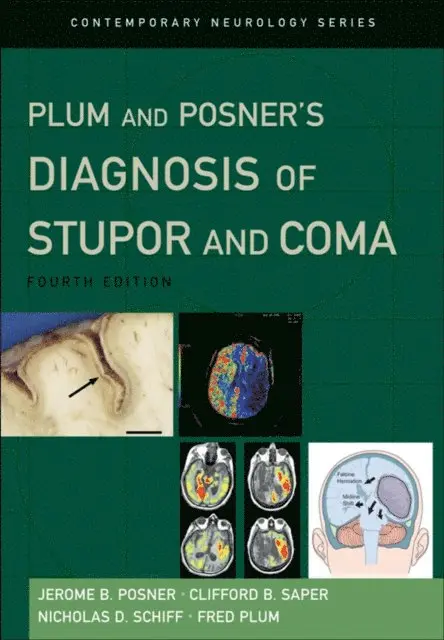 Fred Plum M.D., Nicholas Schiff M.D., Clifford B. Saper M.D., Jerome B. Posner M.D. - Plum and Posner's Diagnosis of Stupor and Coma, E-bok. Tillgänglighet: Lägg i varukorg