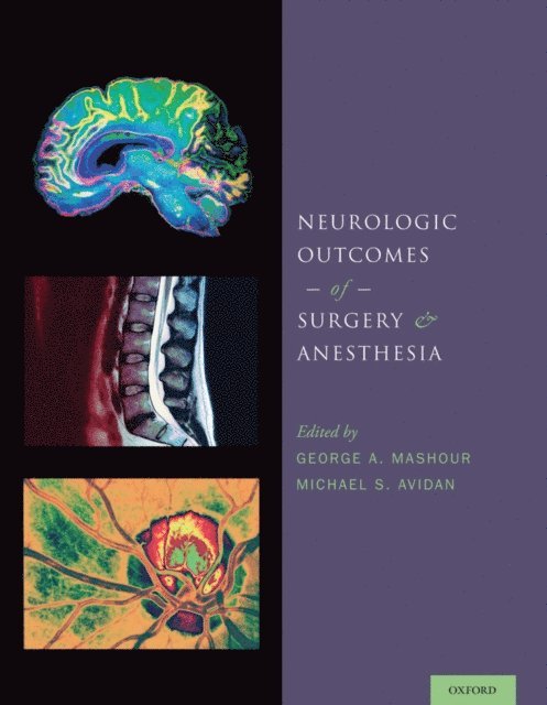 Michael S. Avidan, George A. Mashour - Neurologic Outcomes of Surgery and Anesthesia, E-bok