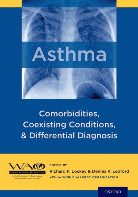 MD Dennis K. Ledford, MD Richard F. Lockey - Asthma, E-bok