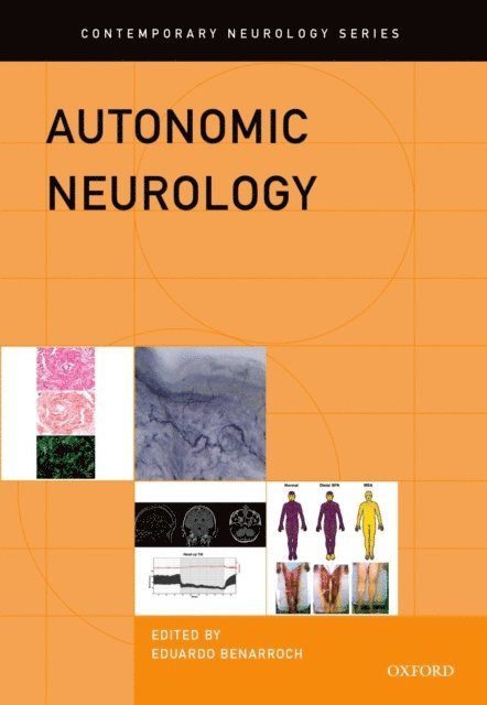 Eduardo E. Benarroch - Autonomic Neurology, E-bok