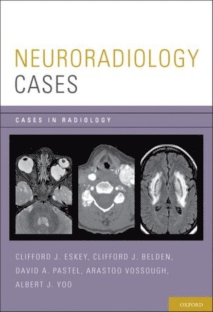 Albert J. Yoo, Arastoo Vossough, David A. Pastel, Clifford J. Belden, Clifford J. Eskey - Neuroradiology Cases, E-bok