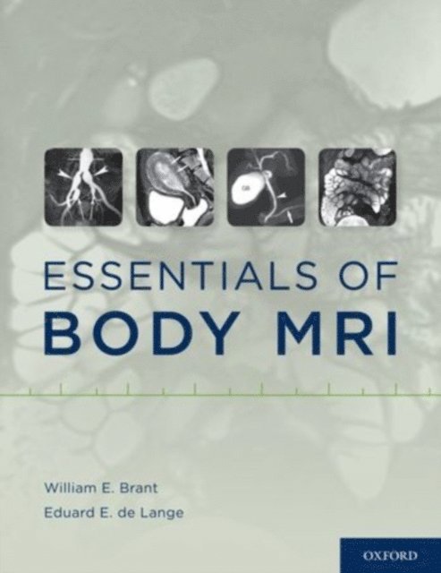Eduard E. de Lange, William E. Brant - Essentials of Body MRI, E-bok