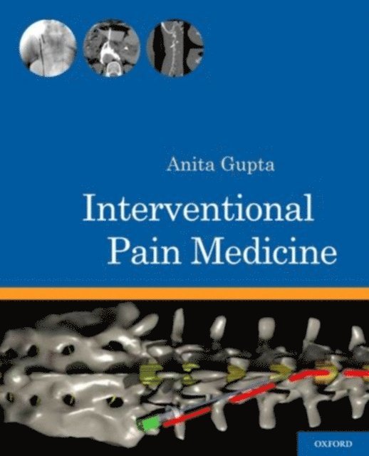 Anita Gupta - Interventional Pain Medicine, E-bok