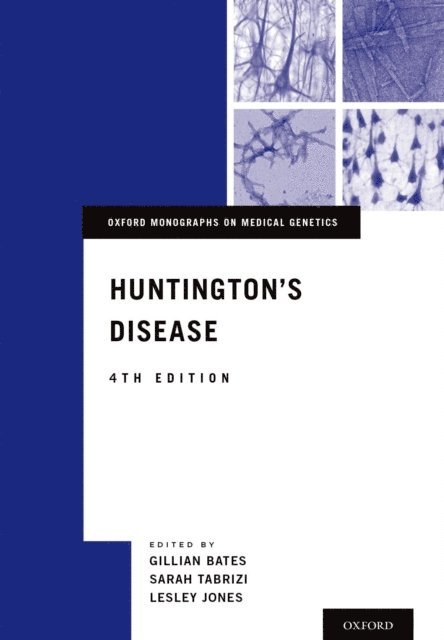 Lesley Jones, Sarah Tabrizi, Gillian Bates - Huntington's Disease, E-bok