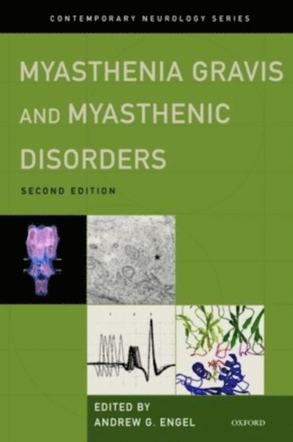Andrew G. Engel - Myasthenia Gravis and Myasthenic Disorders, E-bok