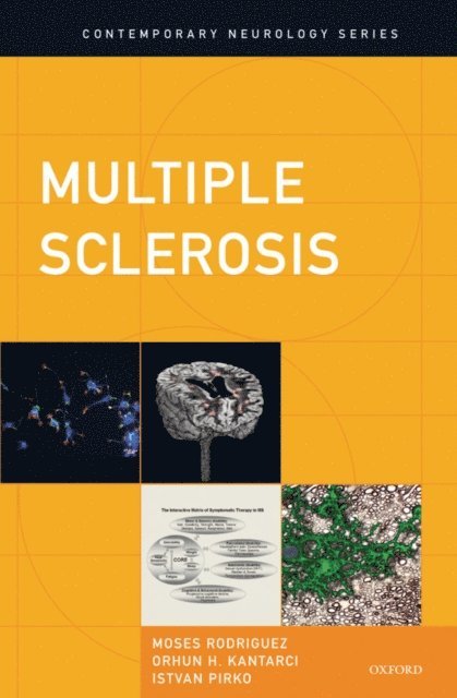 Istvan Pirko, Orhun H. Kantarci, Moses Rodriguez - Multiple Sclerosis, E-bok