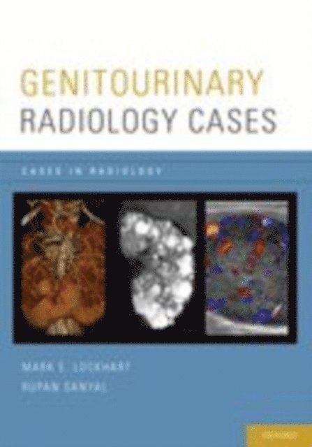 Rupan Sanyal, Mark E. Lockhart - Genitourinary Radiology Cases, E-bok