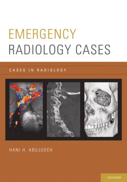 Hani H. Abujudeh - Emergency Radiology Cases, E-bok