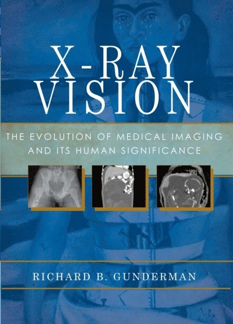 Richard B. Gunderman - X-Ray Vision, E-bok