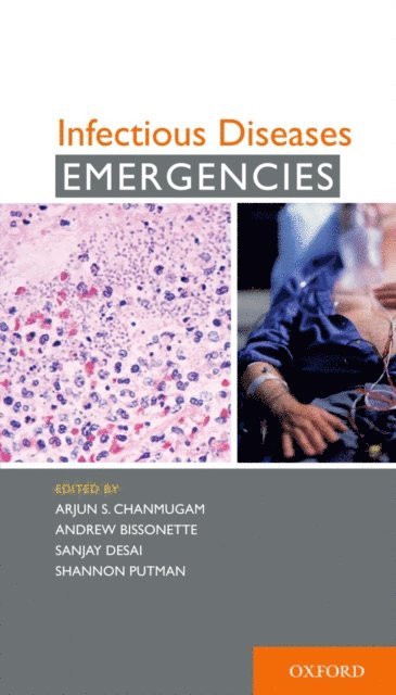 Shannon Putman, Sanjay Desai, Andrew Bissonette,, Arjun S. Chanmugam - Infectious Diseases Emergencies, E-bok