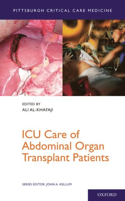 Ali Al-Khafaji - ICU Care of Abdominal Organ Transplant Patients, E-bok