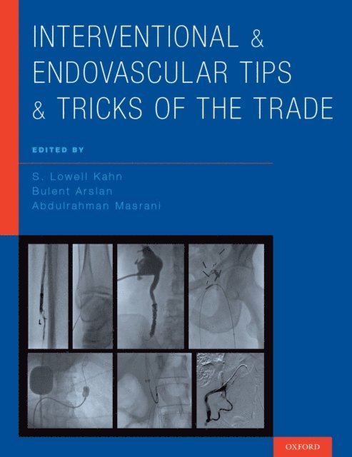 Abdulrahman Masrani, Bulent Arslan, S. Lowell Kahn - Interventional and Endovascular Tips and Tricks of the Trade, E-bok