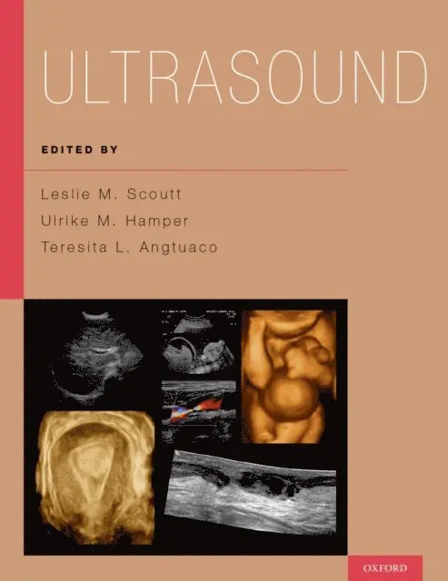 Teresita L. Angtuaco, Ulrike M. Hamper, Leslie M. Scoutt - Ultrasound, E-bok. Tillgänglighet: Lägg i varukorg