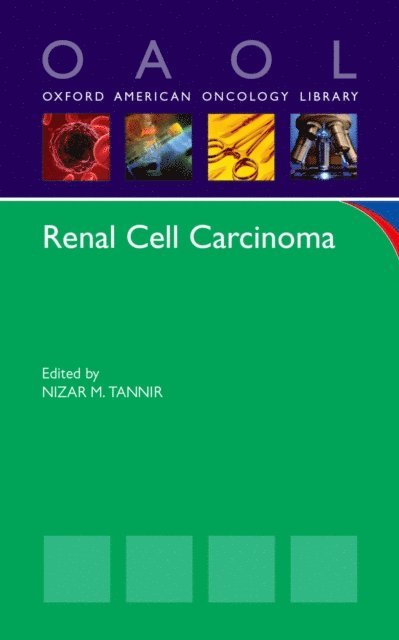 Nizar M. Tannir - Renal Cell Carcinoma, E-bok. Tillgänglighet: Lägg i varukorg