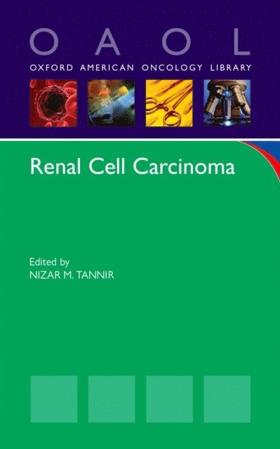 Nizar M. Tannir - Renal Cell Carcinoma, E-bok. Tillgänglighet: Lägg i varukorg