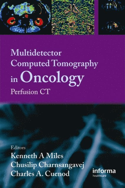 C. Cuenod, C. Charnsangavej, Kenneth Miles - Multi-Detector Computed Tomography in Oncology, E-bok
