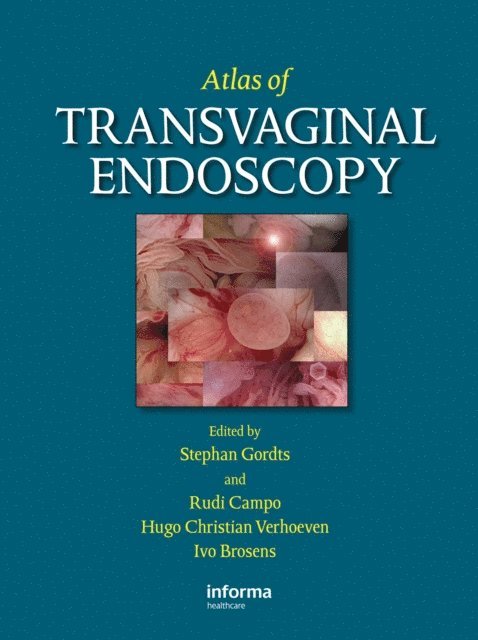 Ivo Brosens, Rudi Campo, Hugo C. Verhoeven, Stephan Gordts - Atlas of Transvaginal Endoscopy, E-bok
