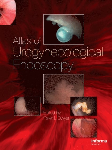 Peter L. Dwyer - Atlas of Urogynecological Endoscopy, E-bok
