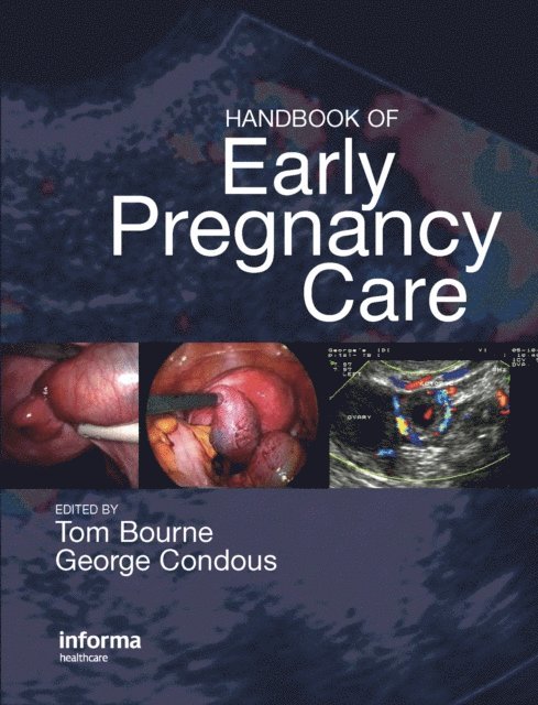 George Condous, Thomas H. Bourne - Handbook of Early Pregnancy Care, E-bok