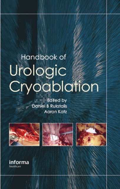 Aaron E. Katz, Daniel Rukstalis - Handbook of Urologic Cryoablation, E-bok