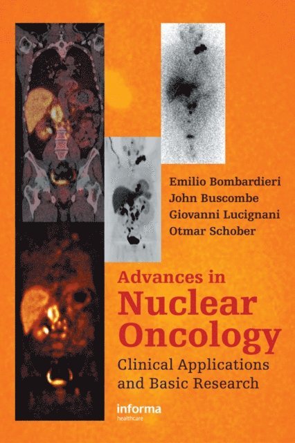 Otmar Schober, Giovanni Lucignani, John Buscombe, Emilio Bombardieri - Advances in Nuclear Oncology, E-bok