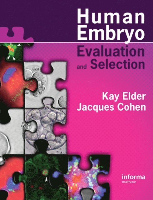 Jacques Cohen, Kay Elder - Human Preimplantation Embryo Selection, E-bok