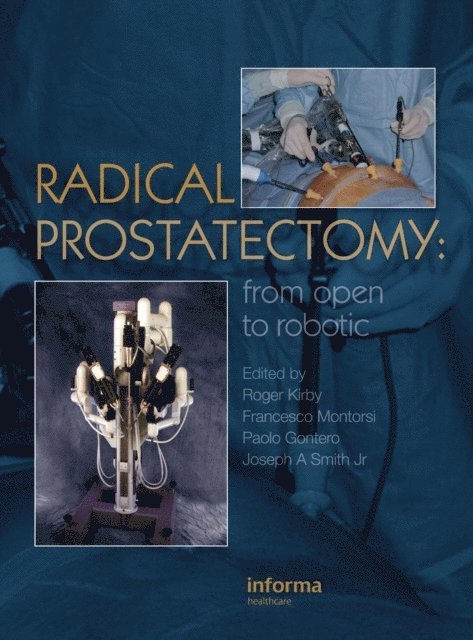 Paolo Gontero, Joseph A Smith, Francesco Montorsi, Roger Kirby - Radical Prostatectomy, E-bok