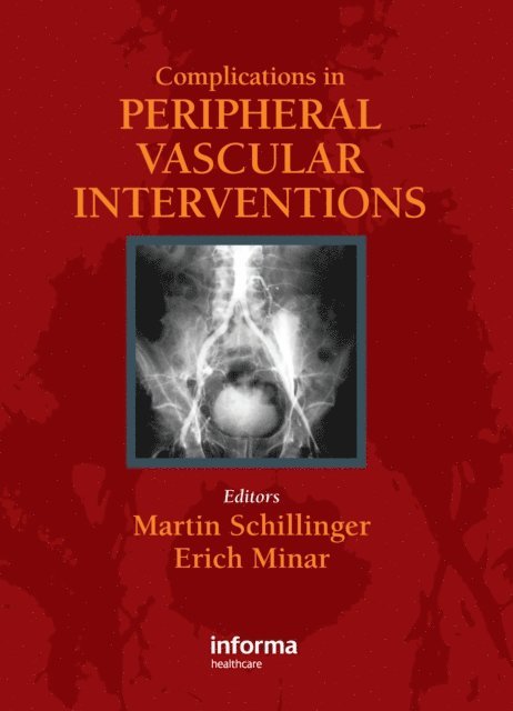 Erich Minar, Martin Schillinger - Complicatons in Peripheral Vascular Interventions, E-bok. Tillgänglighet: Lägg i varukorg