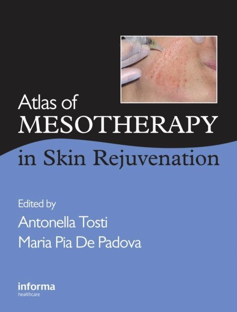 Maria Pia De Padova, Antonella Tosti - Atlas of Mesotherapy in Skin Rejuvenation, E-bok
