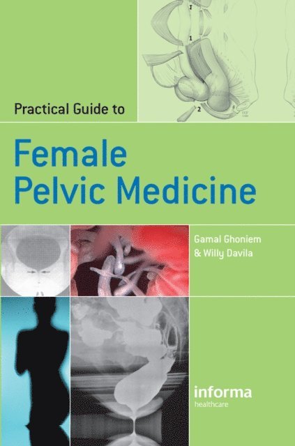 Willy Davila, Gamal Ghoniem - Practical Guide to Female Pelvic Medicine, E-bok