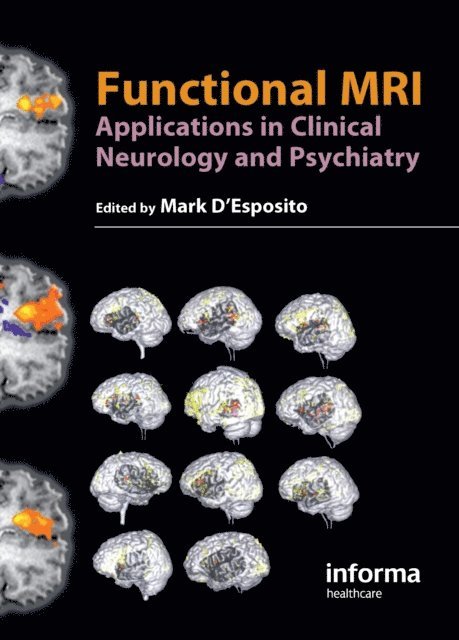 Mark D'Esposito - Functional MRI, E-bok