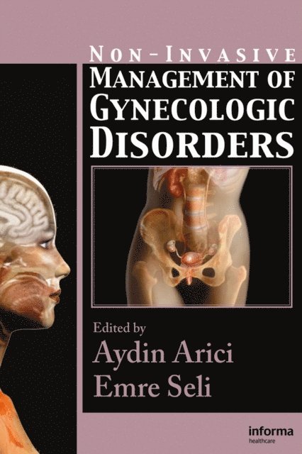 Emre Seli, Aydin Arici - Non-Invasive Management of Gynecologic Disorders, E-bok
