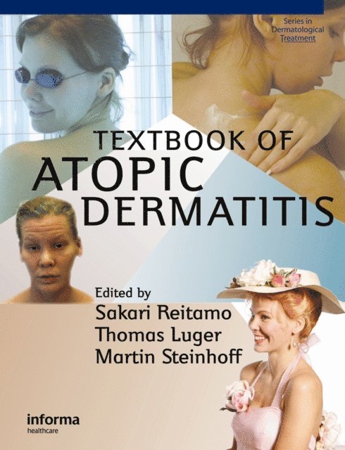 Martin Steinhoff, Thomas A. Luger, Sakari Reitamo - Textbook of Atopic Dermatitis, E-bok