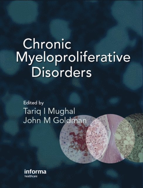 John M. Goldman, Tariq Mughal - Chronic Myeloproliferative Disorders, E-bok
