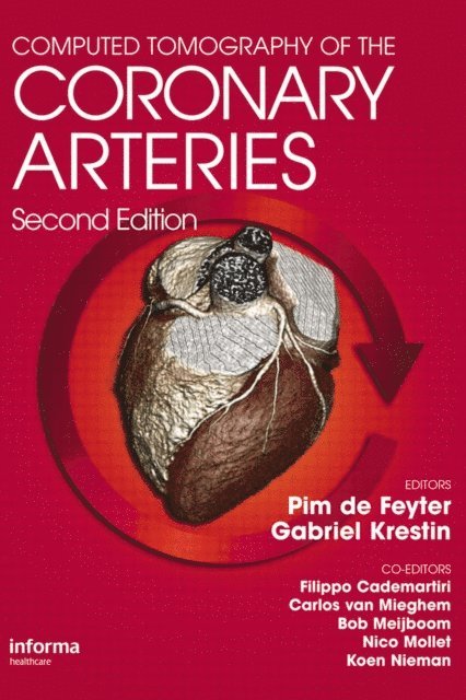G. P. Gabriel Krestin, Pim J. de Feyter - Computed Tomography of the Coronary Arteries, E-bok