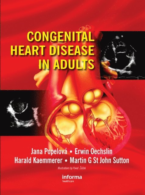 Martin G. St. John Sutton, Harald Kaemmerer, Erwin Oechslin, Jana Popelova - Congenital Heart Disease in Adults, E-bok