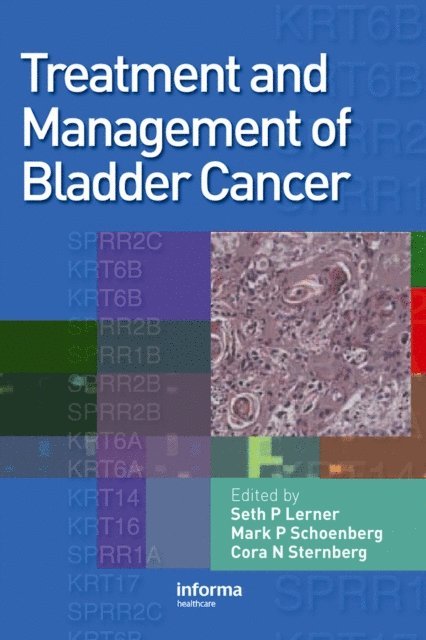 Cora N Sternberg, Mark P Schoenberg, Seth P. Lerner - Treatment and Management of Bladder Cancer, E-bok