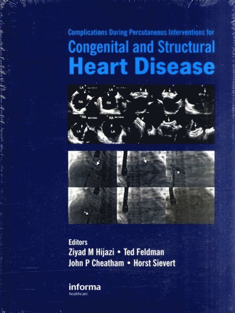 Horst Sievert, John Cheatham, Ted Feldman, Ziyad M. Hijazi - Complications During Percutaneous Interventions for Congenital and Structural Heart Disease, E-bok